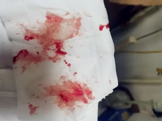 臭脚窒息导致拍摄终止