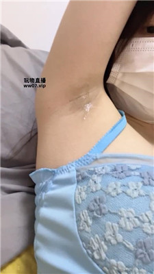 【兔牙】腋下口水    250317-17